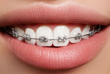 orthodentist in meerut